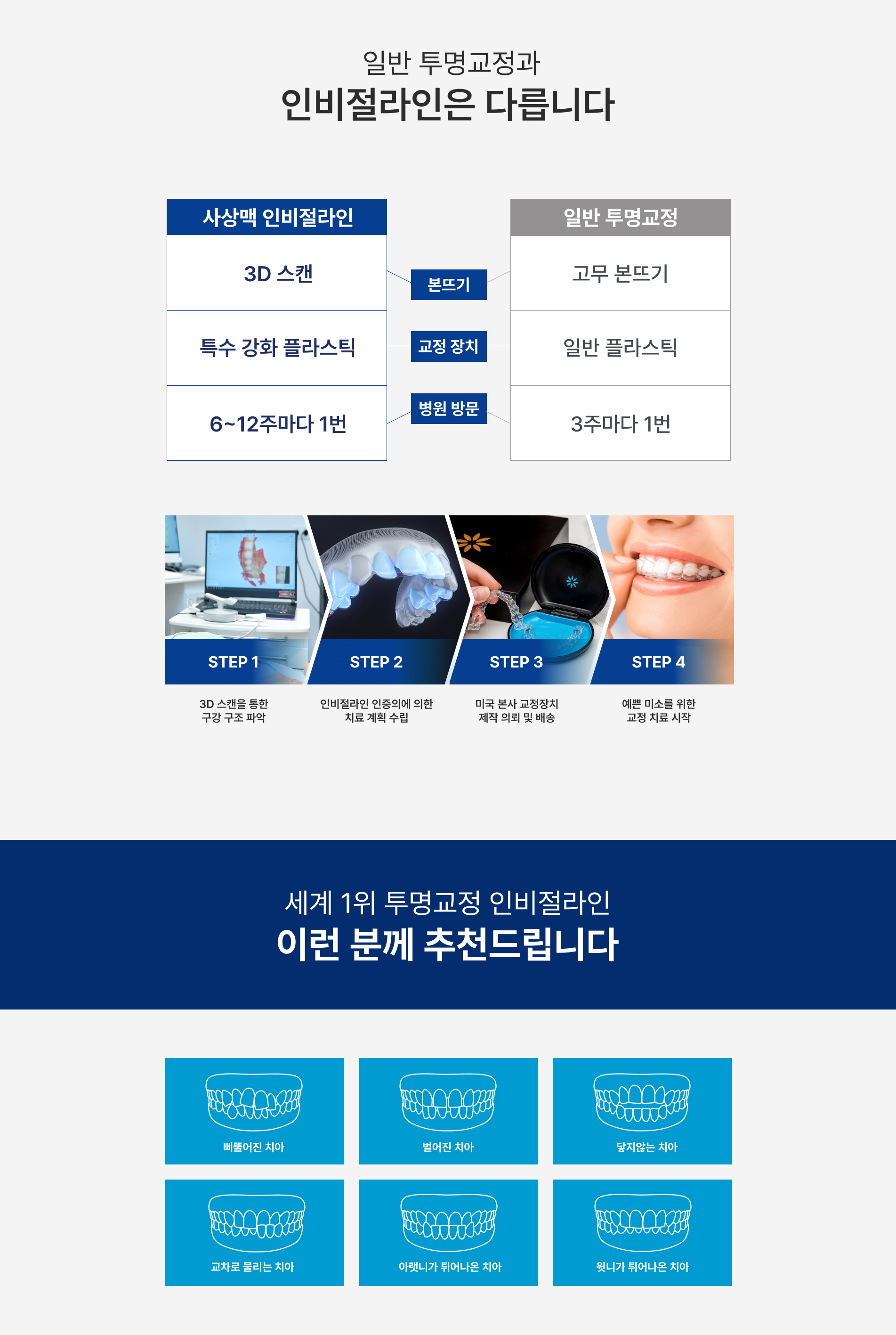 사상맥치과 인비절라인